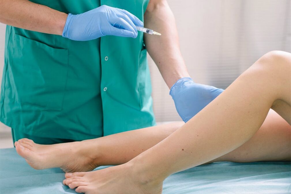Sklerotherapie zur Entfernung von Krampfadern
